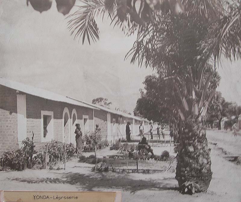 The Leprosarium of Yonda, the Belgian Congo