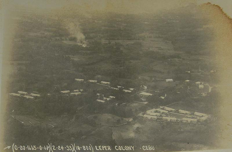 The Leprosy Colony in Cebu (Culion Museum and Archives)